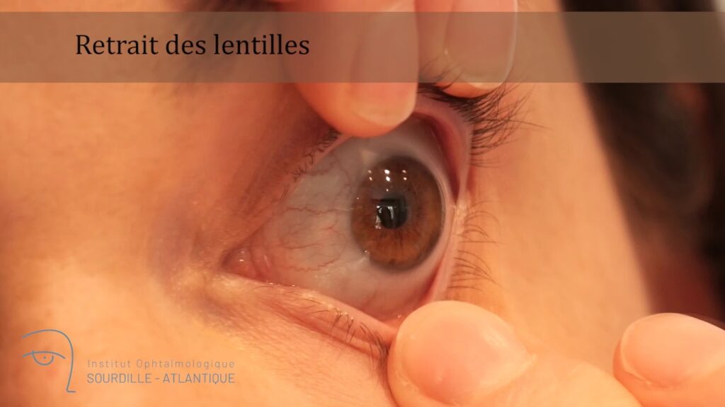 Comment utiliser des lentilles mensuelles ?